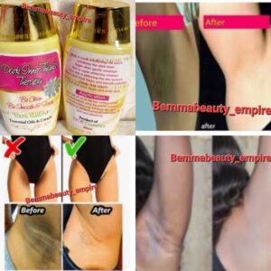 Evob Dark inner thighs, Dark Ampit, anti white dots oil