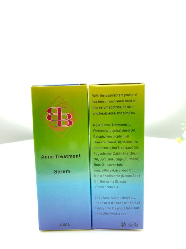 Acne and pimple Treatment Duo set. Soap+ Serum - Image 3