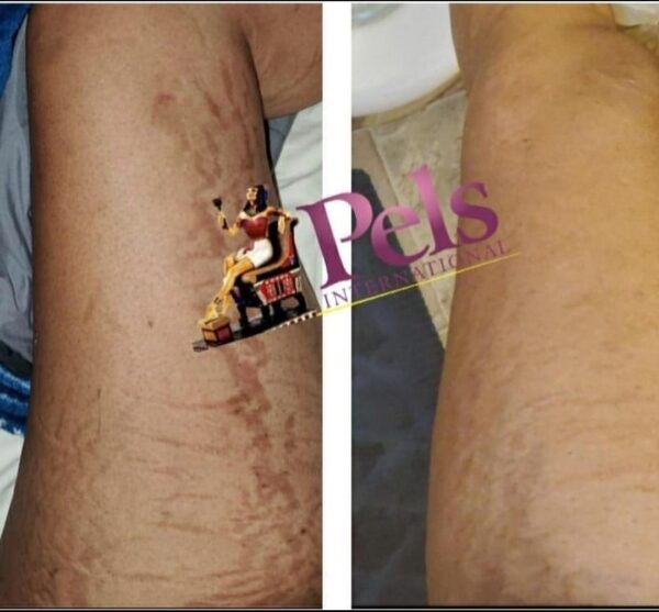 Restoration Healing oil + Cream - Image 3