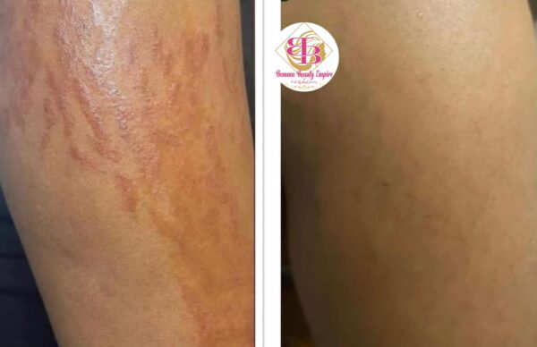 Stretch marks Magical Cream +Soap +Scrub. 3products - Image 9