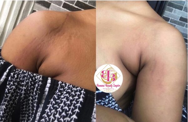 Stretch marks Magical Cream +Soap +Scrub. 3products - Image 8