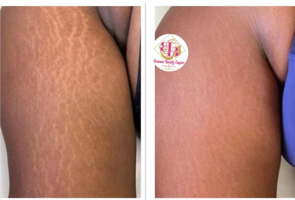 Stretch marks Magical Cream and oil. 2products - Image 7