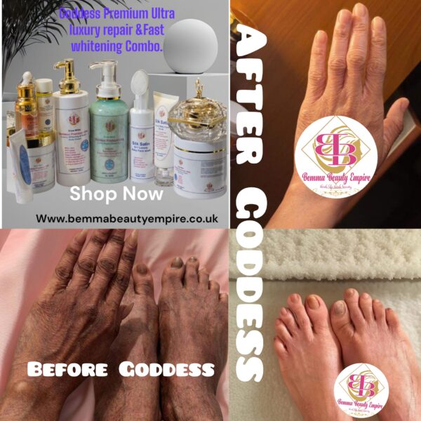 Goddess Premium Ultra Luxury Repair & Fast Whitening (snow White) 10products. Combo