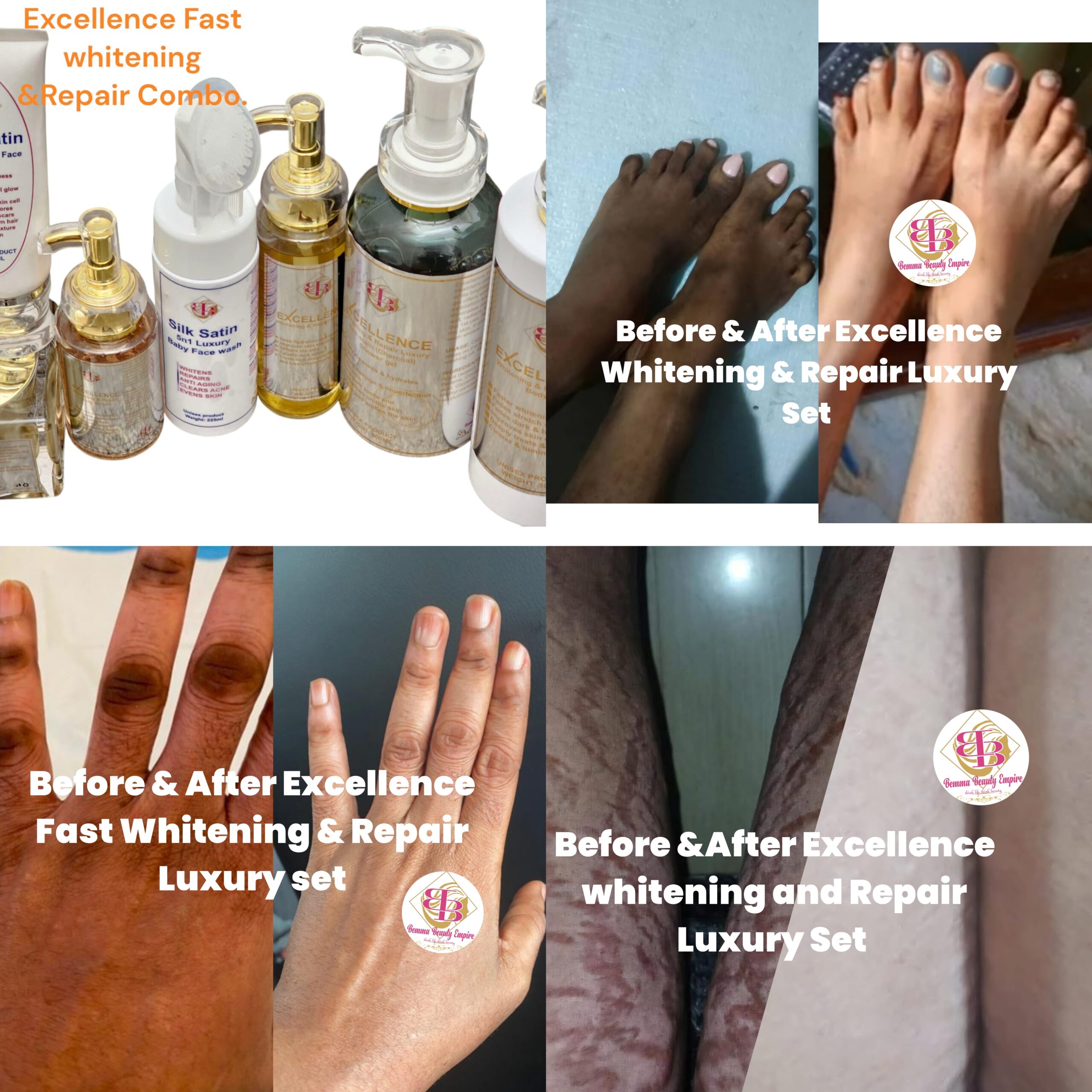 Excellence Fast Whitening &Repair Luxury  7n1 set